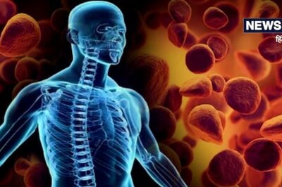 Physical Therapy To Exercise, 5 Ways to Deal With Muscle Weakness