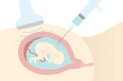 What Is Amniocentesis: What Are The Benefits And Risks Of The Procedure?