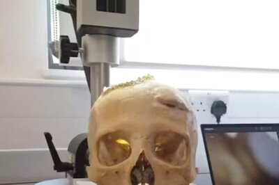 Research Shows Ancient Egyptians Attempted Cancer Surgery Over 4,700 Years Ago