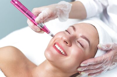 Can MicroNeedling Really Treat Acne Scars? Find Out