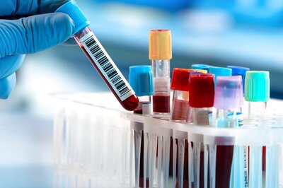 Delhi Govt to Provide 450 Types of Medical Tests Free of Cost from Jan 1