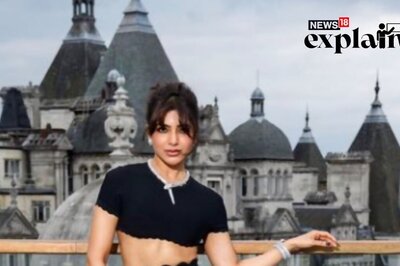 Samantha Sports Ex Naga Chaitanya's Tattoo: All Your Questions About Tattoo Removal Answered