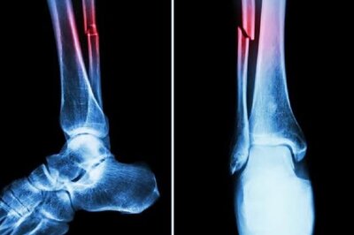 Vegetarianism Linked with Increased Risk of Bone Fractures