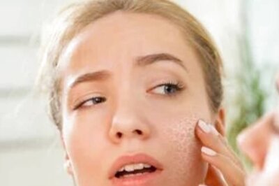What Is Skin Peeling And Here Is How You Can Avoid It During Summers