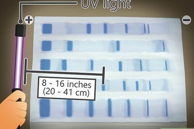 How to Read Gel Electrophoresis Bands