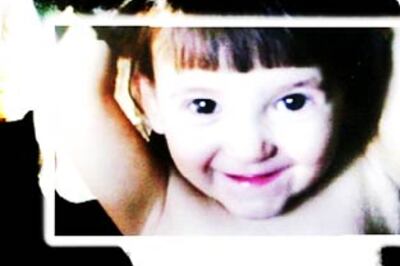 Raised by pets, 5-yr-old girl barks instead of talking