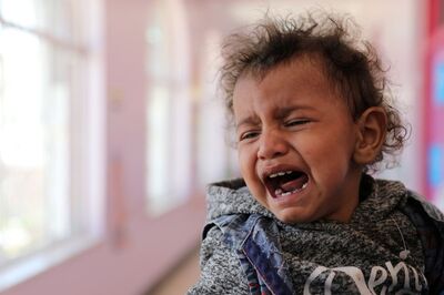 Malnourishment in 11% of Karnataka's Kids Worrisome Amid Fear of Third Covid-19 Wave, Say Experts