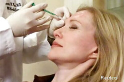 Botox injection heals facial wound faster