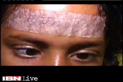 Bihar: People injured in earthquake marked with 'bhukamp' stickers in Darbhanga hospital