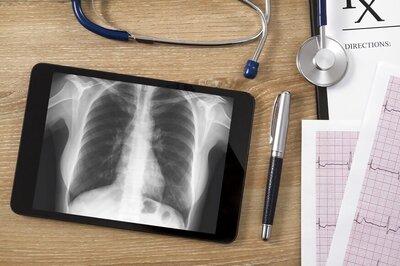 Donor Lungs Over Age 60 Safe For Transplantation: Study