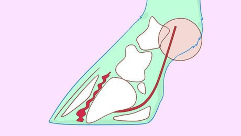 How to Recognize and Treat Laminitis (Founder) in Horses