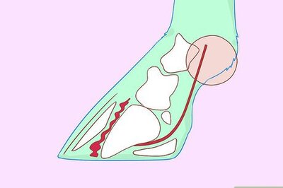How to Recognize and Treat Laminitis (Founder) in Horses