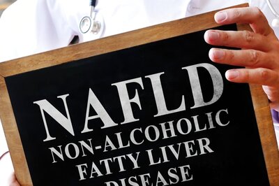 This Liver Disease Can Hit You even if You Don’t Drink Alcohol