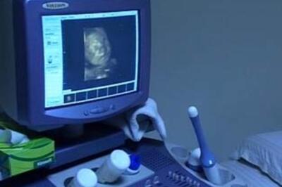 Female foeticide: Ministry changes but will attitudes?