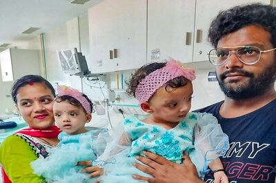 Medical Marvel: AIIMS Delhi Successfully Separates Conjoined Twins Riddhi and Siddhi, Celebrates First Birthday