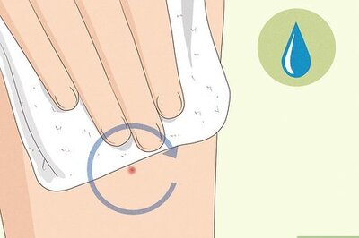 How to Remove Deep Ingrown Hairs