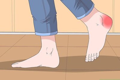 How to Treat a Heel Bruise