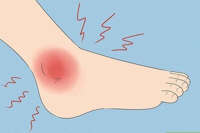 How to Treat a Broken Ankle