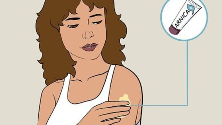 How to Care for a Bruise Naturally