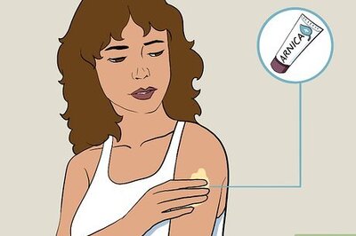 How to Care for a Bruise Naturally