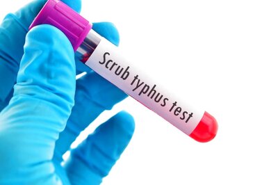 Kerala Reports Second Death Due to Scrub Typhus. All About the Disease, Its Symptoms & Treatment