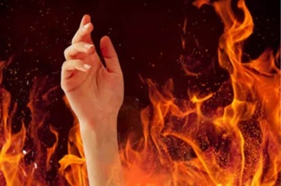 Pune Watchman Set Afire by Man for Objecting to him Urinating on Firm Owner's Car