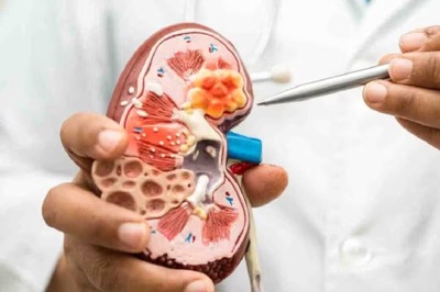 Blood In Urine To Back Pain, 5 Warning Signs Of Kidney Stones