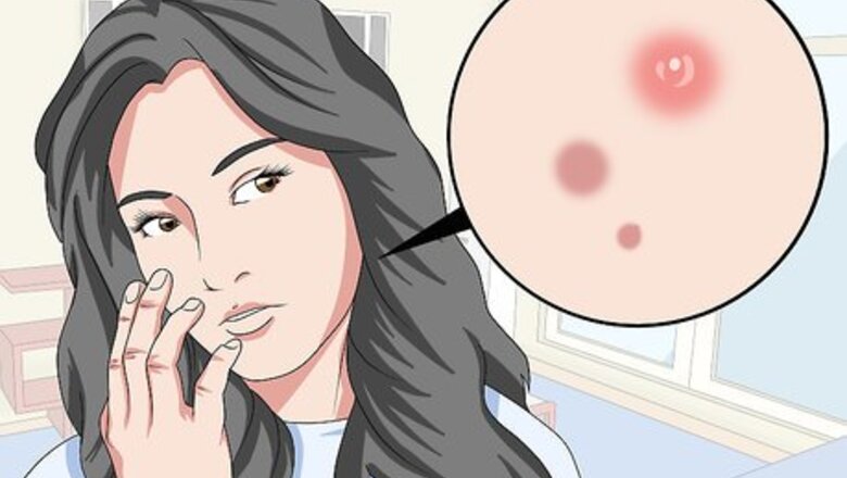 How to Treat Skin with Glycolic Acid