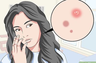 How to Treat Skin with Glycolic Acid