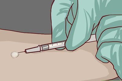 How to Read a Tuberculosis Skin Test