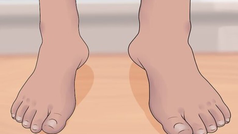How to Recognize and Prevent Lymphatic Filariasis