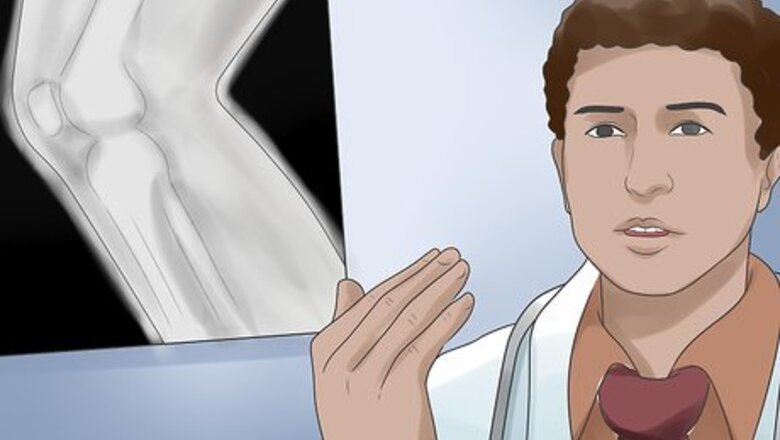 How to Heal after Arthroscopic Knee Surgery