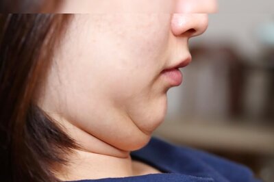 4 Easy Tips To Reduce Your Double Chin