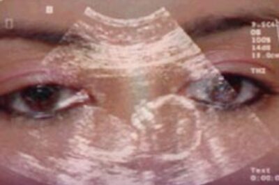  Full Coverage: Big City Blues