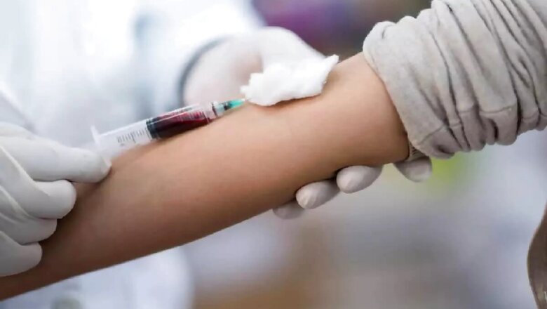 All You Need To Know About Different Blood Tests And How They Help