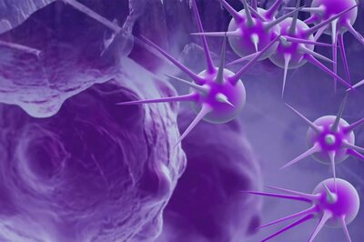 Study Shows How Cancer Cell Evade Our Bodies’ Immune System