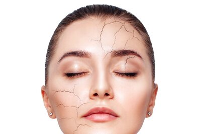 Dermatologist Shares Tips To Control Atopic Dermatitis Flare-Ups During Winter