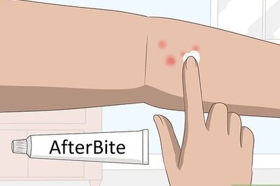 How to Stop Gnat Bites from Itching