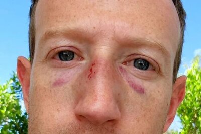Mark Zuckerberg Shares Selfie With Bruises And Injuries on Face, Here is What Happened