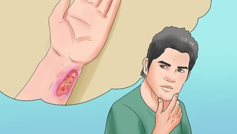 How to Prevent Botulism