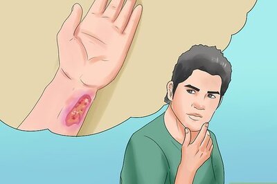 How to Prevent Botulism