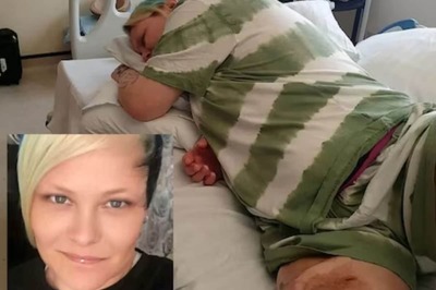 UK Woman, After Undergoing 55 Surgeries In Leg, Wants Amputation