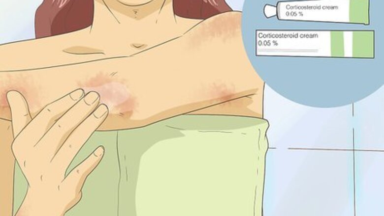 How to Get Rid of Psoriasis