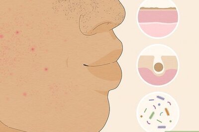 How to Get Rid of Skin Impurities