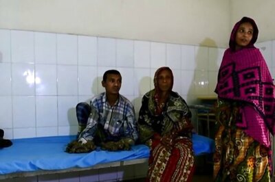 Bangladeshi 'Tree Man' Dreams of Cure as Rare Skin Disease Returns With Growth in New Parts of Body