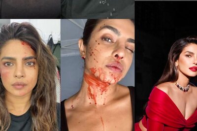 Priyanka Chopra Shares Blood-Stained Selfies, Says ‘Ready To Do This All Over Again’ For Citadel 2