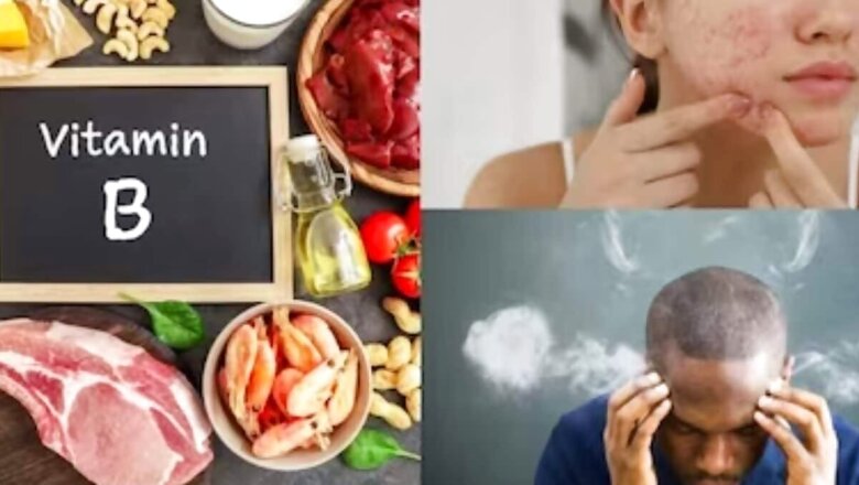 Does Your Body Lack Vitamin B12? Know Symptoms And Solutions To Overcome Deficiency