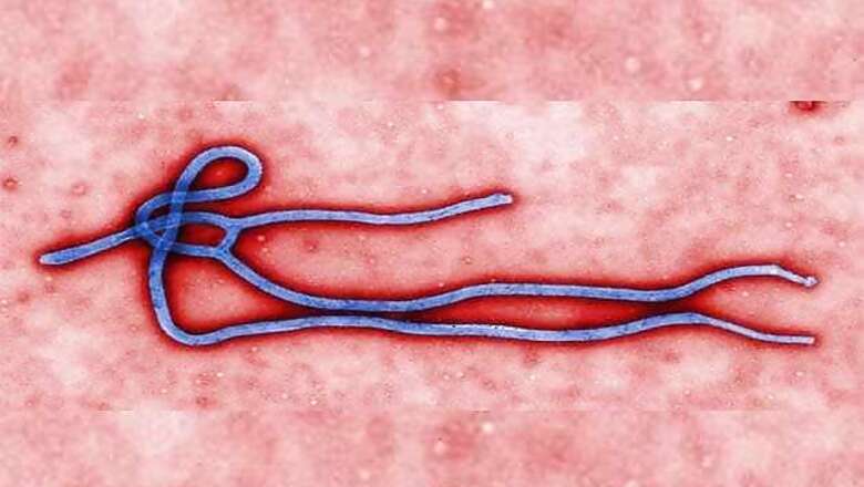 French scientists devise fast-track test for Ebola