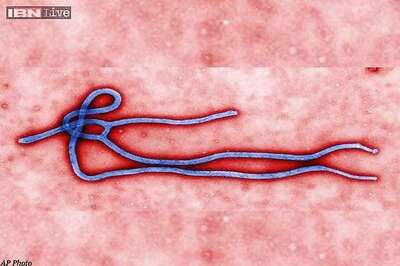 French scientists devise fast-track test for Ebola