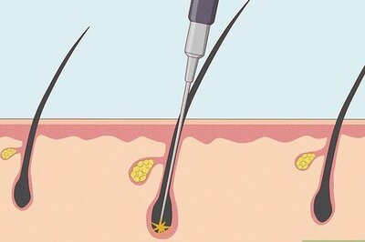 How to Remove Pubic Hair Permanently